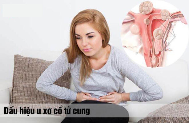 U XƠ TỬ CUNG LÀ GÌ?